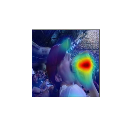 Grad-CAM